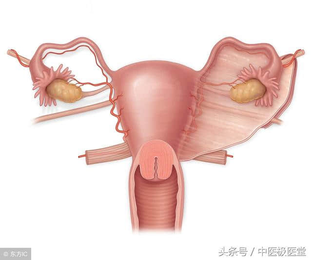 桂枝茯苓丸在中医妇科中的作用